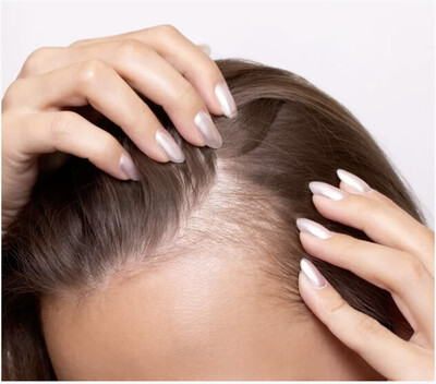 Link to: /pages/prp-therapy-for-hair-loss-treatment
