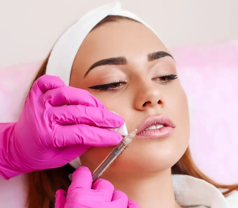 Girl getting dermal fillers at Space Aesthetics in San Mateo, CA