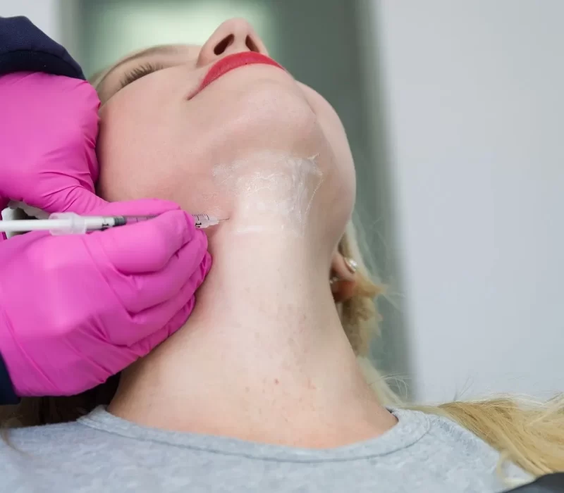 Lady getting Kybella Injectable Treatment for Double Chin in San Mateo, CA